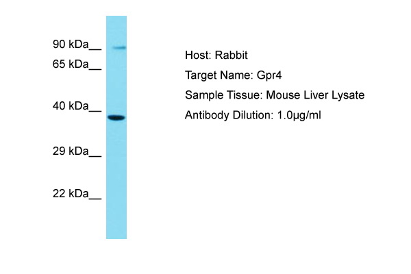 GPR4 Antibody -  This image was taken for the unconjugated form of this product. Other forms have not been tested.