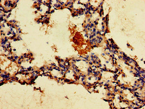 GPR4 Antibody - Immunohistochemistry of paraffin-embedded human lung tissue at dilution of 1:100