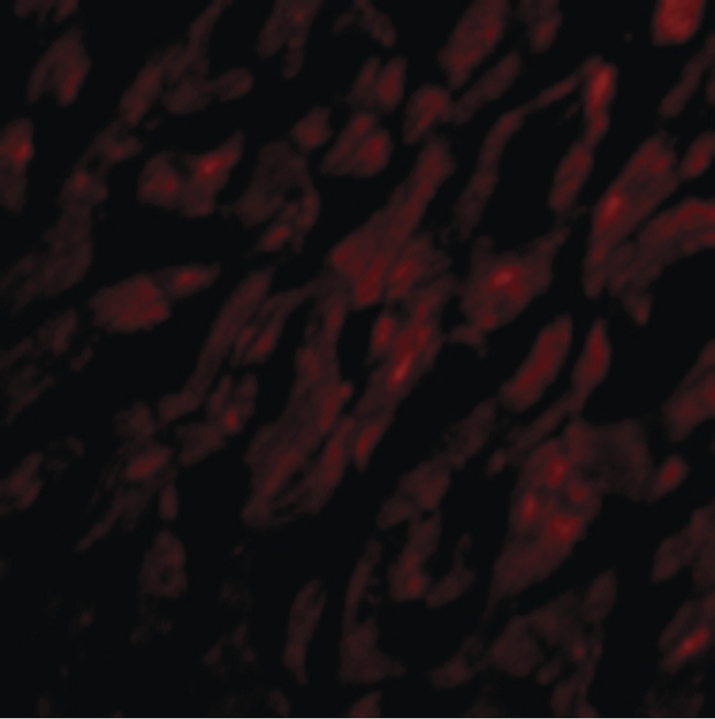 GPR44 / CRTH2 Antibody - Immunofluorescence of CRTH2 in Human Heart cells with CRTH2 antibody at 20 ug/ml.