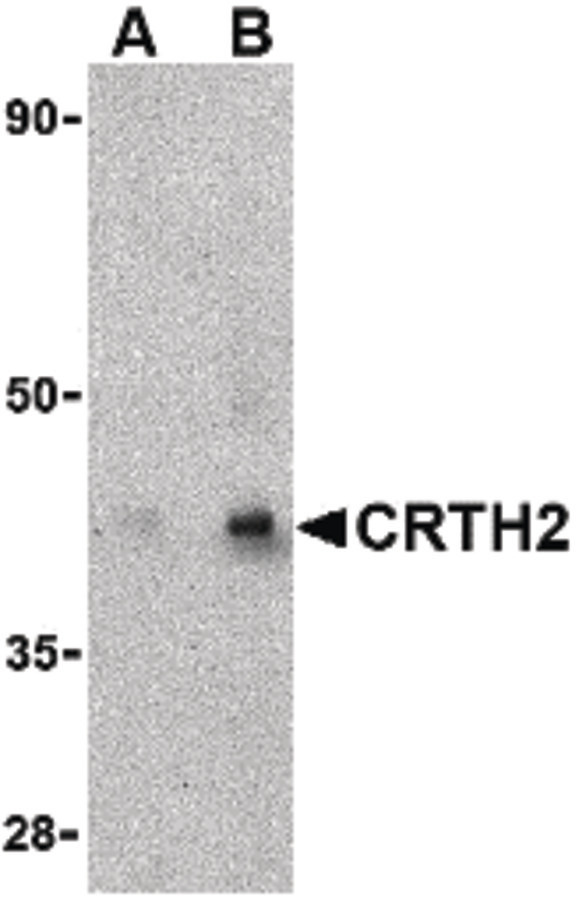 GPR44 / CRTH2 Antibody - Western blot of CRTH2 in human heart tissue lysate with CRTH2 antibody at (A) 1 and (B) 2 ug/ml.