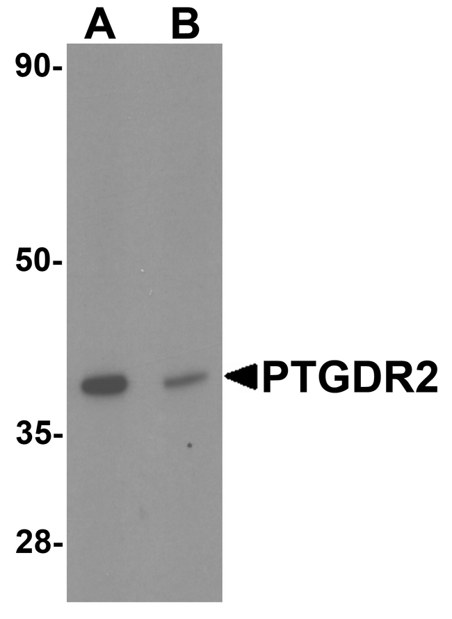 GPR44 / CRTH2 Antibody - Western blot analysis of PTGDR2 in small intestine tissue lysate with PTGDR2 antibody at 1 ug/ml in (A) the absence and (B) the presence of blocking peptide.