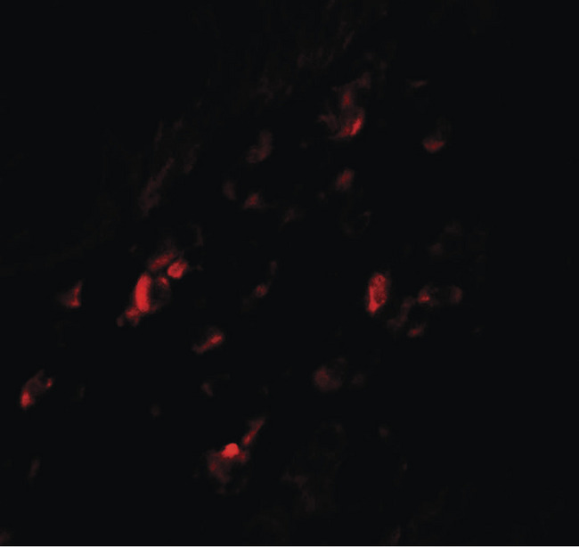 GPR44 / CRTH2 Antibody - Immunofluorescence of PTGDR2 in human small intestine tissue with PTGDR2 antibody at 20 ug/ml.