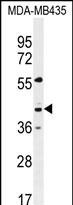 GPR45 Antibody - GPR45 Antibody (Center) western blot analysis in MDA-MB435 cell line lysates (35ug/lane).This demonstrates the GPR45 antibody detected the GPR45 protein (arrow).