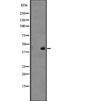 GPR45 Antibody - Western blot analysis of GPR45 expression in NT2D1 whole cells lysate. The lane on the left is treated with the antigen-specific peptide.