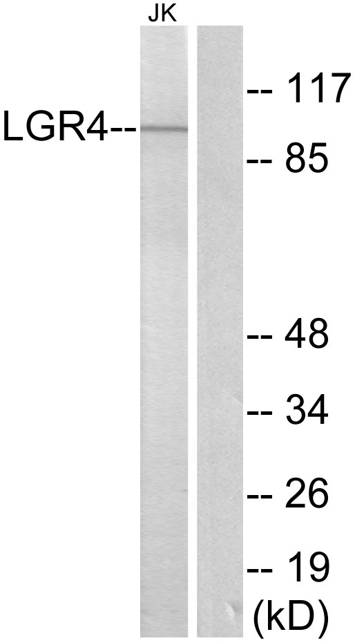 GPR48 / LGR4 Antibody - Western blot analysis of lysates from Jurkat cells, using LGR4 Antibody. The lane on the right is blocked with the synthesized peptide.