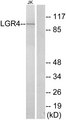 GPR48 / LGR4 Antibody - Western blot analysis of lysates from Jurkat cells, using LGR4 Antibody. The lane on the right is blocked with the synthesized peptide.
