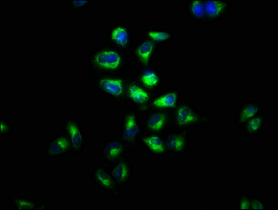 GPR48 / LGR4 Antibody - Immunofluorescence staining of Hela cells with LGR4 Antibody at 1:100, counter-stained with DAPI. The cells were fixed in 4% formaldehyde, permeabilized using 0.2% Triton X-100 and blocked in 10% normal Goat Serum. The cells were then incubated with the antibody overnight at 4°C. The secondary antibody was Alexa Fluor 488-congugated AffiniPure Goat Anti-Rabbit IgG(H+L).