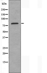 GPR48 / LGR4 Antibody - Western blot analysis of extracts of Jurkat cells using LGR4 antibody.
