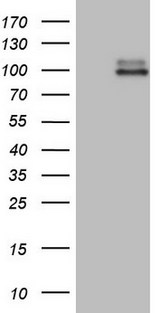 GPR49 / LGR5 Antibody - HEK293T cells were transfected with the pCMV6-ENTRY control. (Left lane) or pCMV6-ENTRY LGR5. (Right lane) cDNA for 48 hrs and lysed. Equivalent amounts of cell lysates. (5 ug per lane) were separated by SDS-PAGE and immunoblotted with anti-LGR5. (1:2000)