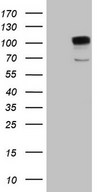 GPR49 / LGR5 Antibody - HEK293T cells were transfected with the pCMV6-ENTRY control. (Left lane) or pCMV6-ENTRY LGR5. (Right lane) cDNA for 48 hrs and lysed