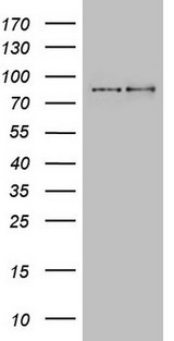 GPR49 / LGR5 Antibody - Western blot analysis of extracts. (15ug) from 2 Human tissue by using anti-LGR5 monoclonal antibody(left lane: Brain right lane: Testis). (1:200)