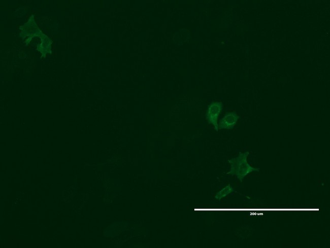 GPR49 / LGR5 Antibody - Anti-LGR5 mouse monoclonal antibody  immunofluorescent staining of MCF7 cells transiently transfected by pCMV6-ENTRY mouse LGR5. (1:100)