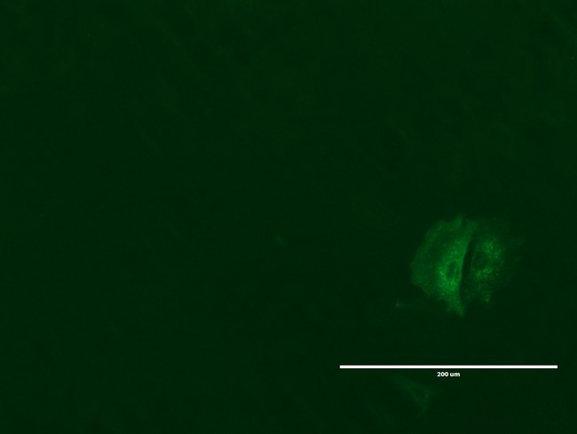 GPR49 / LGR5 Antibody - Anti-LGR5 mouse monoclonal antibody immunofluorescent staining of MCF7 cells transiently transfected by pCMV6-ENTRY human LGR5. (1:100)
