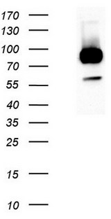 GPR49 / LGR5 Antibody - NIH-3T3. (Left lane) or stable expressed LGR5-3T3. (Right lane) cell lysates. (5 ug per lane) were separated by SDS-PAGE and immunoblotted with anti-LGR5. (1:1000)