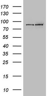 GPR49 / LGR5 Antibody - Western blot analysis of extracts. (15ug) from 2 Human tissue by using anti-LGR5 monoclonal antibody(left lane: Brain right lane: Testis). (1:2000)