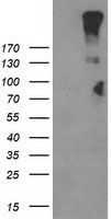 GPR49 / LGR5 Antibody - HEK293T cells were transfected with the pCMV6-ENTRY control (Left lane) or pCMV6-ENTRY LGR5 (Right lane) cDNA for 48 hrs and lysed. Equivalent amounts of cell lysates (5 ug per lane) were separated by SDS-PAGE and immunoblotted with anti-LGR5.