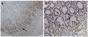 GPR49 / LGR5 Antibody - Figure from citation: Immunohistochemical staining of Lgr5 in normal gastric tissues. The normal gastric tissue, 40×magnified. (A) and 400× magnified. (B). Yellowspots represent the Lgr5 positive cells that are localized only at base of the glands in normal gastric mucosa. The arrows in the pictures show the immunoreactive cells stained in yellow color.