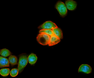 GPR49 / LGR5 Antibody - Immunofluorescent staining of HT29 cells using anti-LGR5 mouse monoclonal antibody  green). Actin filaments were labeled with TRITC-phalloidin. (red), and nuclear with DAPI. (blue).