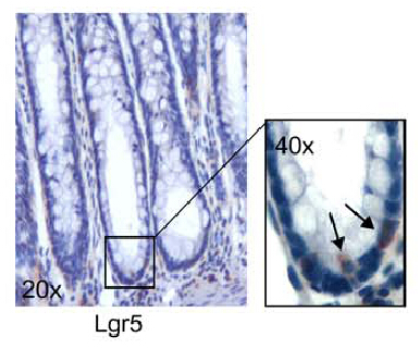 GPR49 / LGR5 Antibody - Figure from citation: Immunohistochemical analysis of Lgr5 expression in human normal colon biopsies; Lgr5+ cells are localized at the crypt base, where bona fide stem-like cells home; magnification is indicated in the boxes. Dilution: 1:200