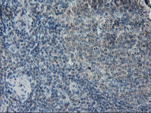 GPR49 / LGR5 Antibody - Immunohistochemical staining of paraffin-embedded Human lymph node tissue within the normal limits using anti-LGR5 mouse monoclonal antibody. (Heat-induced epitope retrieval by 10mM citric buffer, pH6.0, 100C for 10min,