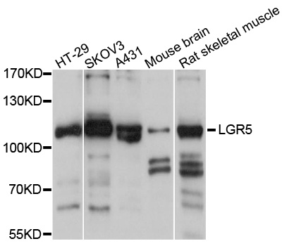 GPR49 / LGR5 Antibody - Western blot analysis of extracts of various cells.