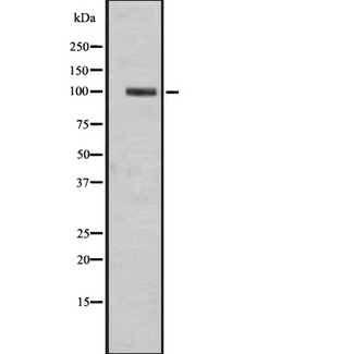 GPR49 / LGR5 Antibody - Western blot analysis of LGR5 expression in K562 cells line lysates. The lane on the left is treated with the antigen-specific peptide.