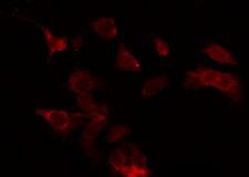 GPR49 / LGR5 Antibody - Staining HeLa cells by IF/ICC. The samples were fixed with PFA and permeabilized in 0.1% Triton X-100, then blocked in 10% serum for 45 min at 25°C. The primary antibody was diluted at 1:200 and incubated with the sample for 1 hour at 37°C. An Alexa Fluor 594 conjugated goat anti-rabbit IgG (H+L) Ab, diluted at 1/600, was used as the secondary antibody.