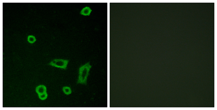 GPR50 Antibody - Immunofluorescence analysis of LOVO cells, using MTR1L Antibody. The picture on the right is blocked with the synthesized peptide.