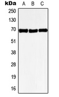 GPR50 Antibody - Western blot analysis of GPR50 expression in HeLa (A); SP2/0 (B); PC12 (C) whole cell lysates.