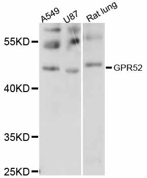 GPR52 Antibody - Western blot analysis of extracts of various cell lines, using GPR52 antibody at 1:1000 dilution. The secondary antibody used was an HRP Goat Anti-Rabbit IgG (H+L) at 1:10000 dilution. Lysates were loaded 25ug per lane and 3% nonfat dry milk in TBST was used for blocking. An ECL Kit was used for detection and the exposure time was 10s.