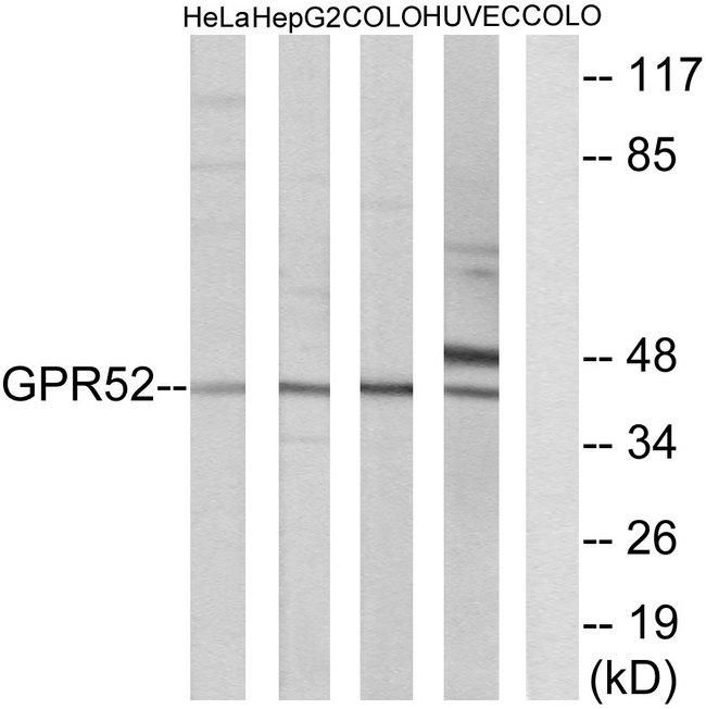 GPR52 Antibody - Western blot analysis of extracts from HeLa cells, HepG2 cells, COLO cells and HUVEC cells, using GPR52 antibody.