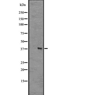 GPR55 Antibody - Western blot analysis of GPR55 expression in HEK293 cells. The lane on the left is treated with the antigen-specific peptide.