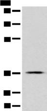 GPR55 Antibody - Western blot analysis of PC-3 cell lysate  using GPR55 Polyclonal Antibody at dilution of 1:500