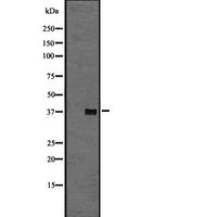 GPR6 Antibody - Western blot analysis of GPR6 expression in A431 whole cells lysate. The lane on the left is treated with the antigen-specific peptide.