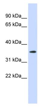 GPR6 Antibody - Western blot of placenta lysate.  This image was taken for the unconjugated form of this product. Other forms have not been tested.
