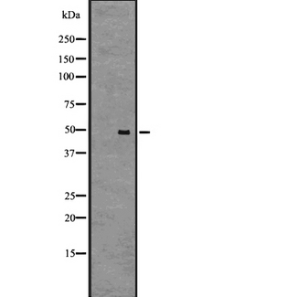 GPR61 Antibody - Western blot analysis of GPR61 expression in A431 cells lysate. The lane on the left is treated with the antigen-specific peptide.