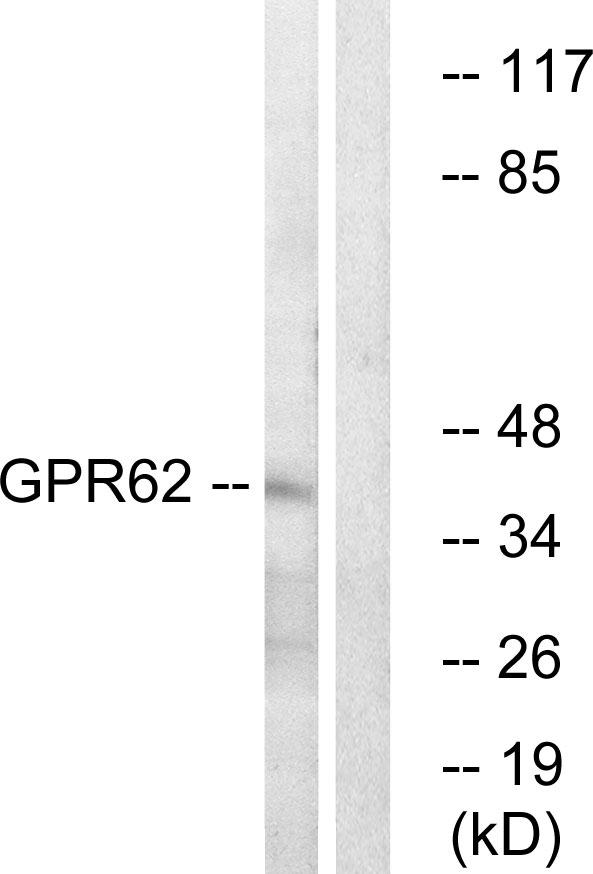 GPR62 Antibody - Western blot analysis of lysates from COLO cells, using GPR62 Antibody. The lane on the right is blocked with the synthesized peptide.