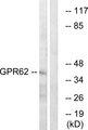 GPR62 Antibody - Western blot analysis of extracts from COLO cells, using GPR62 antibody.
