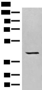 GPR62 Antibody - Western blot analysis of A549 cell lysate  using GPR62 Polyclonal Antibody at dilution of 1:350