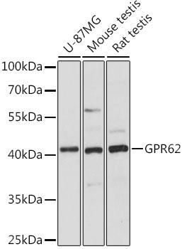 GPR62 Antibody - Western blot analysis of extracts of various cell lines using GPR62 Polyclonal Antibody at dilution of 1:1000.