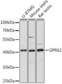 GPR62 Antibody - Western blot analysis of extracts of various cell lines using GPR62 Polyclonal Antibody at dilution of 1:1000.