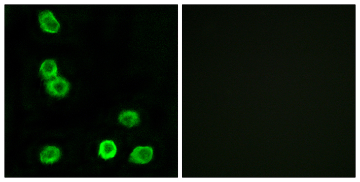GPR63 Antibody - Immunofluorescence analysis of MCF7 cells, using GPR63 Antibody. The picture on the right is blocked with the synthesized peptide.