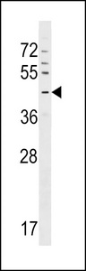 GPR63 Antibody - GPR63 Antibody western blot of CEM cell line lysates (35 ug/lane). The GPR63 antibody detected the GPR63 protein (arrow).