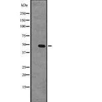 GPR63 Antibody - Western blot analysis of GPR63 expression in CEM cells lysate. The lane on the left is treated with the antigen-specific peptide.