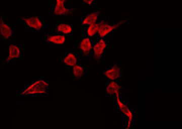 GPR68 / OGR1 Antibody - Staining HeLa cells by IF/ICC. The samples were fixed with PFA and permeabilized in 0.1% Triton X-100, then blocked in 10% serum for 45 min at 25°C. The primary antibody was diluted at 1:200 and incubated with the sample for 1 hour at 37°C. An Alexa Fluor 594 conjugated goat anti-rabbit IgG (H+L) Ab, diluted at 1/600, was used as the secondary antibody.