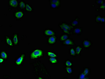GPR75 Antibody - Immunofluorescent analysis of HepG2 cells using GPR75 Antibody at dilution of 1:100 and Alexa Fluor 488-congugated AffiniPure Goat Anti-Rabbit IgG(H+L)