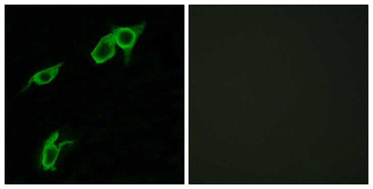 GPR75 Antibody - Immunofluorescence analysis of LOVO cells, using GPR75 Antibody. The picture on the right is blocked with the synthesized peptide.