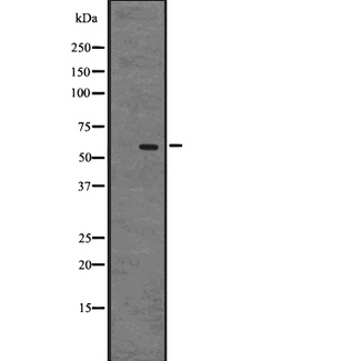 GPR75 Antibody - Western blot analysis of GPR75 expression in A431 whole cells lysate. The lane on the left is treated with the antigen-specific peptide.