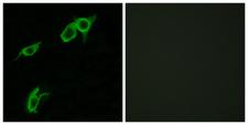 GPR75 Antibody - Peptide - + Immunofluorescence analysis of LOVO cells, using GPR75 antibody.