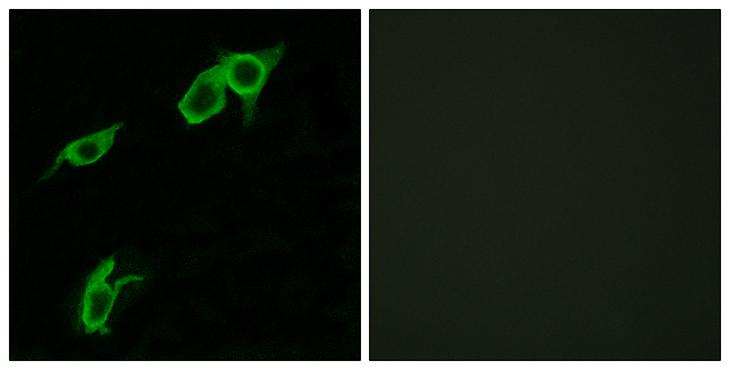 GPR75 Antibody - Peptide - + Immunofluorescence analysis of LOVO cells, using GPR75 antibody.